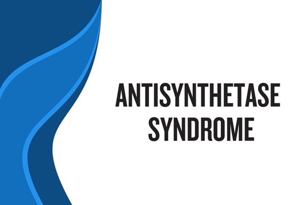 Anti-Synthetase Syndrome